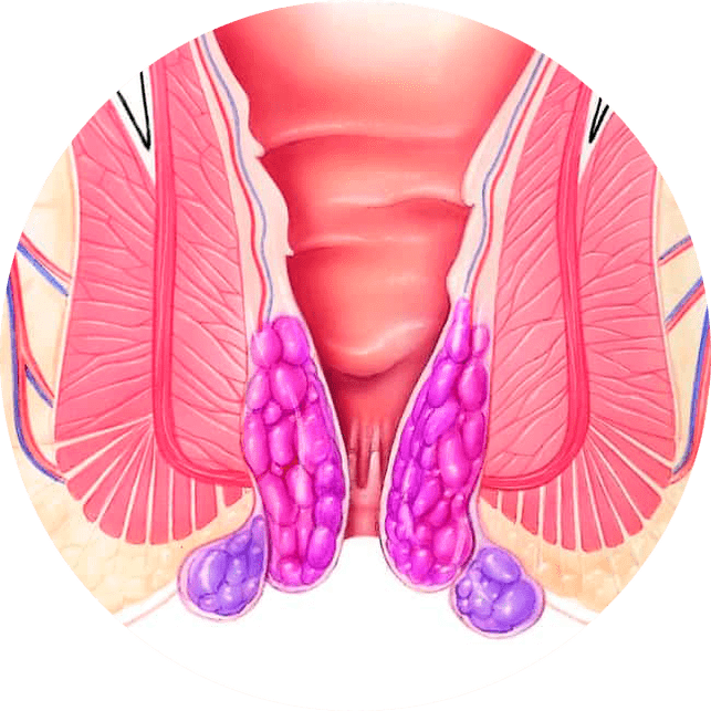 Gelarex allevia i sintomi sin dal primo utilizzo